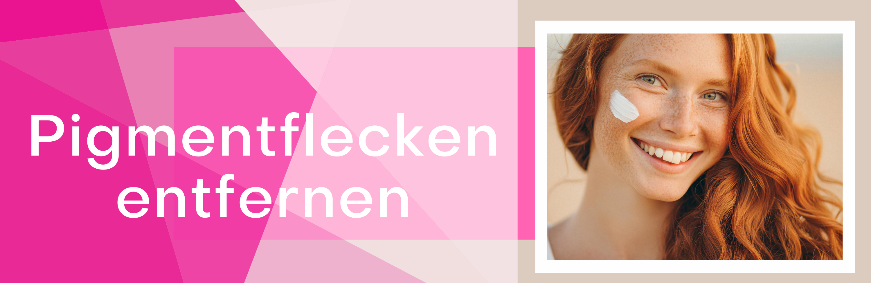 Pigmentflecken entfernen, Hyperpigmentierung